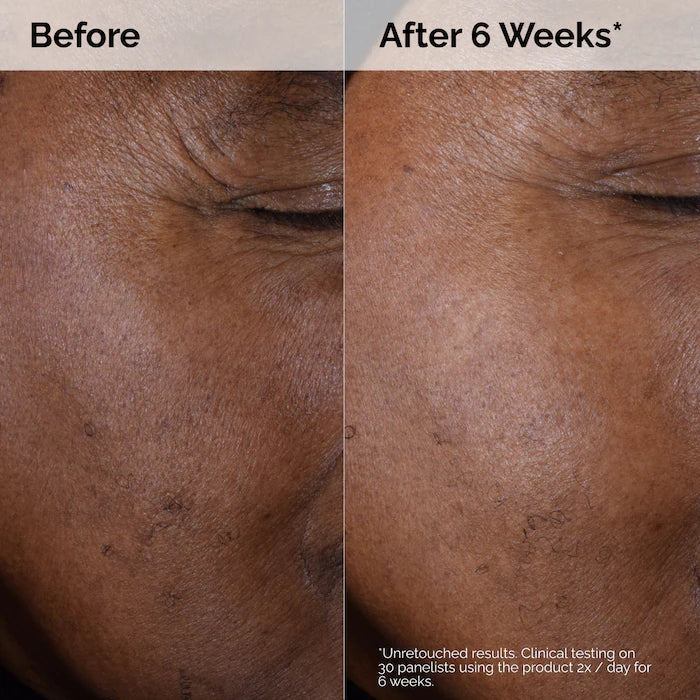 The Ordinary Glycolic Acid 7% Exfoliating Toner