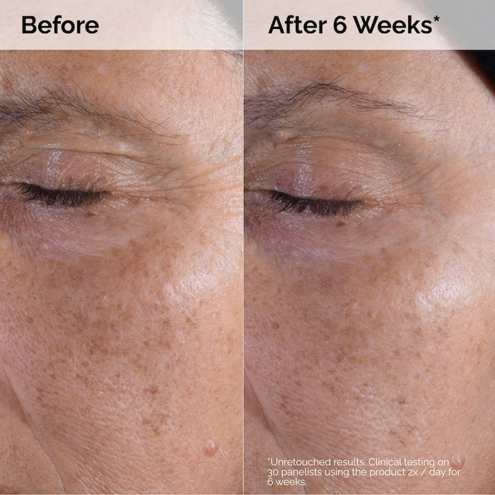 The Ordinary Glycolic Acid 7% Exfoliating Toner