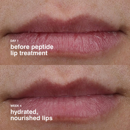 Rhode Peptide Lip Treatment Nourishing Glaze
